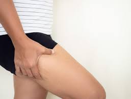 もも裏の硬さの意外な原因!?